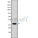 Western blot analysis FOLR2 using HeLa whole cell lysates