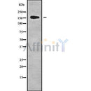 DF9522 at 1/100 staining Mouse lung tissue by IHC-P. The sample was formaldehyde fixed and a heat mediated antigen retrieval step in citrate buffer was performed. The sample was then blocked and incubated with the antibody for 1.5 hours at 22¡ãC. An HRP conjugated goat anti-rabbit antibody was used as the secondary