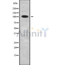 Western blot analysis GCFC1 using Jurkat whole cell lysates