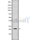 Western blot analysis of CSF3 using Jurkat whole cell lysates