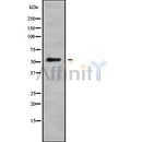DF9545 at 1/100 staining Human brain cancer tissue by IHC-P. The sample was formaldehyde fixed and a heat mediated antigen retrieval step in citrate buffer was performed. The sample was then blocked and incubated with the antibody for 1.5 hours at 22¡ãC. An HRP conjugated goat anti-rabbit antibody was used as the secondary