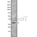 Western blot analysis GCH1 using K562 whole cell lysates