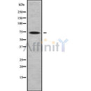 Western blot analysis of extracts from mouse brain, using GTPBP1 Antibody. Lane 1 was treated with the blocking peptide.