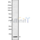 Western blot analysis of extracts from various samples, using GNG13 Antibody.
Lane 1: Mouse brain treated with blocking peptide;
Lane 2: Mouse brain;
Lane 3: MCF7;
Lane 4: 3T3;
Lane 5: HepG2.