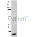 Western blot analysis of extracts from rat brain, using GNG3 Antibody. Lane 1 was treated with the blocking peptide.