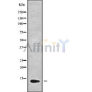 Western blot analysis GUCA2B using K562 whole cell lysates