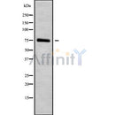 Western blot analysis of extracts from various samples, using HGFAC Antibody.
Lane 1: hybridoma cells treated with blocking peptide.
Lane 2: hybridoma cells;
Lane 3: 293;
