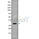 Western blot analysis of HLA-DQB2 using HuvEc whole cell lysates