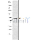 Western blot analysis of extracts from hybridoma cells, using HOXB3 Antibody. Lane 1 was treated with the blocking peptide.