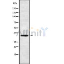 Western blot analysis of HOXC11 using MCF7 whole cell lysates