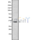 Western blot analysis of extracts from hybridoma cells, using HOXC13 Antibody. Lane 1 was treated with the blocking peptide.