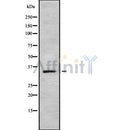 Western blot analysis of HOXD11 using MCF7 whole cell lysates