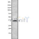 Western blot analysis of HOXD13 using COLO205 whole cell lysates