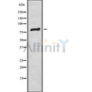 DF9592 at 1/100 staining Human spleen tissue by IHC-P. The sample was formaldehyde fixed and a heat mediated antigen retrieval step in citrate buffer was performed. The sample was then blocked and incubated with the antibody for 1.5 hours at 22¡ãC. An HRP conjugated goat anti-rabbit antibody was used as the secondary