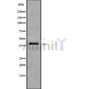 Western blot analysis of A4GALT using K562 whole cell lysates