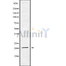 Western blot analysis of extracts from Mouse brain, using MED29 Antibody. The lane on the left was treated with blocking peptide.