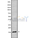 Western blot analysis of MAL using COLO205 whole cell lysates