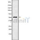 Western blot analysis NDUFV1 using K562 whole cell lysates