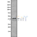 DF9674 at 1/100 staining Mouse kidney tissue by IHC-P. The sample was formaldehyde fixed and a heat mediated antigen retrieval step in citrate buffer was performed. The sample was then blocked and incubated with the antibody for 1.5 hours at 22¡ãC. An HRP conjugated goat anti-rabbit antibody was used as the secondary