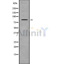 Western blot analysis NPHP1 using HepG2 whole cell lysates