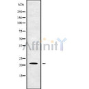 DF9725 at 1/100 staining Rat liver tissue by IHC-P. The sample was formaldehyde fixed and a heat mediated antigen retrieval step in citrate buffer was performed. The sample was then blocked and incubated with the antibody for 1.5 hours at 22¡ãC. An HRP conjugated goat anti-rabbit antibody was used as the secondary
