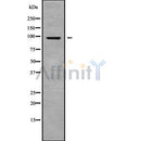 DF9750 at 1/100 staining Human Melanoma tissue by IHC-P. The sample was formaldehyde fixed and a heat mediated antigen retrieval step in citrate buffer was performed. The sample was then blocked and incubated with the antibody for 1.5 hours at 22¡ãC. An HRP conjugated goat anti-rabbit antibody was used as the secondary
