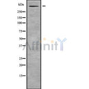 DF9843 at 1/100 staining Human Melanoma tissue by IHC-P. The sample was formaldehyde fixed and a heat mediated antigen retrieval step in citrate buffer was performed. The sample was then blocked and incubated with the antibody for 1.5 hours at 22¡ãC. An HRP conjugated goat anti-rabbit antibody was used as the secondary