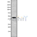 DF9850 at 1/100 staining Human gastric tissue by IHC-P. The sample was formaldehyde fixed and a heat mediated antigen retrieval step in citrate buffer was performed. The sample was then blocked and incubated with the antibody for 1.5 hours at 22¡ãC. An HRP conjugated goat anti-rabbit antibody was used as the secondary