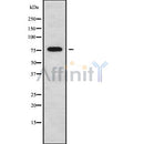 DF9896 at 1/100 staining Mouse liver tissue by IHC-P. The sample was formaldehyde fixed and a heat mediated antigen retrieval step in citrate buffer was performed. The sample was then blocked and incubated with the antibody for 1.5 hours at 22¡ãC. An HRP conjugated goat anti-rabbit antibody was used as the secondary
