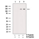 AF3155 at 1/100 staining Mouse intestine tissue by IHC-P. The sample was formaldehyde fixed and a heat mediated antigen retrieval step in citrate buffer was performed. The sample was then blocked and incubated with the antibody for 1.5 hours at 22¡ãC. An HRP conjugated goat anti-rabbit antibody was used as the secondary