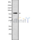 Western blot analysis of extracts from various samples, using NCKIPSD Antibody.
Lane 1: Hela treated with blocking peptide.
Lane 2: Hela;
Lane 3: HepG2;