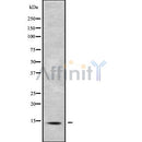 DF9906 at 1/100 staining Human liver tissue by IHC-P. The sample was formaldehyde fixed and a heat mediated antigen retrieval step in citrate buffer was performed. The sample was then blocked and incubated with the antibody for 1.5 hours at 22¡ãC. An HRP conjugated goat anti-rabbit antibody was used as the secondary