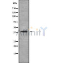 Western blot analysis of extracts from Rat spleen, using SH3GL3 Antibody. The lane on the left was treated with blocking peptide.