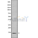 Western blot analysis of CCL27 using Jurkat whole cell lysates