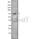 Western blot analysis SLC24A2 using COLO205 whole cell lysates