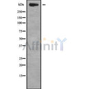 Western blot analysis of TNXB using A549 whole cell lysates