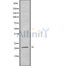 Western blot analysis of extracts from rat brain, using TRAPPC5 Antibody. Lane 1 was treated with the blocking peptide.