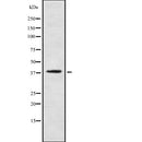 AF9031 staining LOVO by IF/ICC. The sample were fixed with PFA and permeabilized in 0.1% Triton X-100,then blocked in 10% serum for 45 minutes at 25¡ãC. The primary antibody was diluted at 1/200 and incubated with the sample for 1 hour at 37¡ãC. An Alexa Fluor 594 conjugated goat anti-rabbit IgG (H+L) Ab, diluted at 1/600, was used as the secondary antibod
