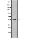 AF9141 at 1/100 staining Human liver cancer tissue by IHC-P. The sample was formaldehyde fixed and a heat mediated antigen retrieval step in citrate buffer was performed. The sample was then blocked and incubated with the antibody for 1.5 hours at 22¡ãC. An HRP conjugated goat anti-rabbit antibody was used as the secondary