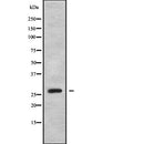 Western blot analysis of extracts from various samples, using OTUB2 Antibody.
Lane 1: 293 treated with blocking peptide.
Lane 2: 293;
Lane 3: Hela;