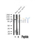 Western blot analysis of extracts from Mouse lung, using INCENP Antibody. The lane on the left was treated with blocking peptide.