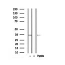Western blot analysis of extracts from mouse kidney, using Phospho-ketohexokinase(S81) Antibody.
