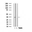 Western blot analysis of extracts from Hela, using Phospho-PRPS1(S180) Antibody.