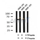 AF7069 at 1/100 staining mouse kidney tissue sections by IHC-P. The tissue was formaldehyde fixed and a heat mediated antigen retrieval step in citrate buffer was performed. The tissue was then blocked and incubated with the antibody for 1.5 hours at 22¡ãC. An HRP conjugated goat anti-rabbit antibody was used as the secondary