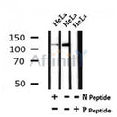 Western blot analysis of Phospho-GLI2(Ser234) in lysates of HeLa?, using Phospho-GLI2(Ser234) Antibody(AF7072).