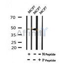 Western blot analysis of Phospho-TFAP2C(Ser434) in lysates of MCF7 , using Phospho-TFAP2C(Ser434) Antibody(AF7082).