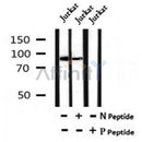 Western blot analysis of Phospho-FoxO3a (Ser555) in lysates of Jurkat?, using Phospho-FoxO3a (Ser555) Antibody(AF7123).