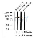 AF7160 at 1/100 staining rat lung tissue sections by IHC-P. The tissue was formaldehyde fixed and a heat mediated antigen retrieval step in citrate buffer was performed. The tissue was then blocked and incubated with the antibody for 1.5 hours at 22¡ãC. An HRP conjugated goat anti-rabbit antibody was used as the secondary