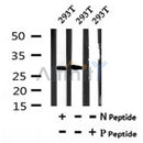AF7165 at 1/100 staining mouse lung tissue sections by IHC-P. The tissue was formaldehyde fixed and a heat mediated antigen retrieval step in citrate buffer was performed. The tissue was then blocked and incubated with the antibody for 1.5 hours at 22¡ãC. An HRP conjugated goat anti-rabbit antibody was used as the secondary