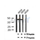 AF7193 at 1/100 staining human colon cancer tissue sections by IHC-P. The tissue was formaldehyde fixed and a heat mediated antigen retrieval step in citrate buffer was performed. The tissue was then blocked and incubated with the antibody for 1.5 hours at 22¡ãC. An HRP conjugated goat anti-rabbit antibody was used as the secondary